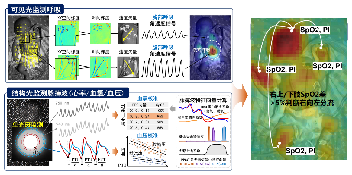 医疗人工智能新蓝海深圳三院南科大团队成功攻关非接触式生命体征监测