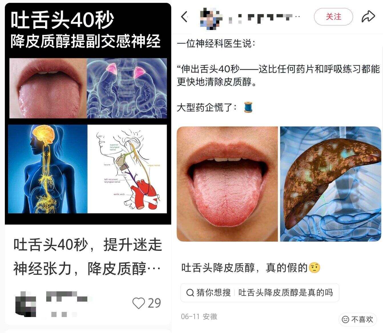 伸舌头能降皮质醇?神经科医生:过度演绎了! - 21经济网